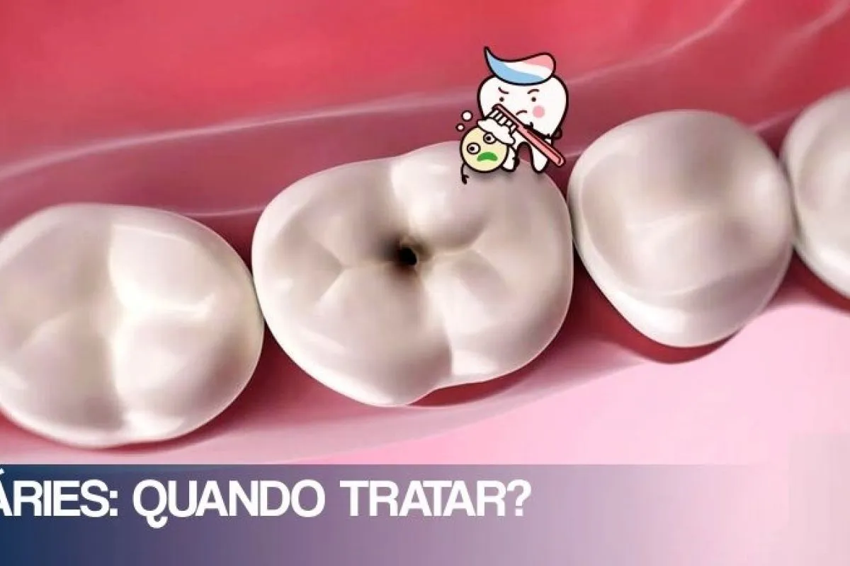 a cárie do dente doi