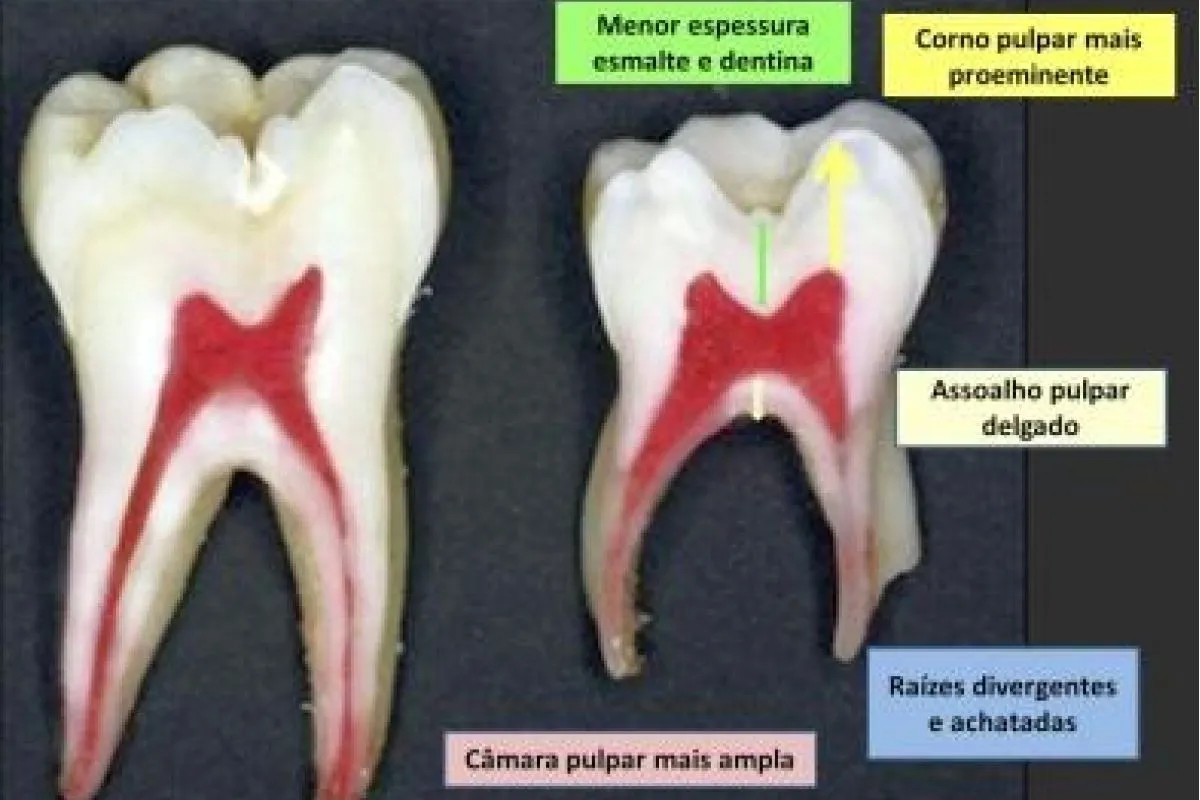 dente de leite e dente permanente