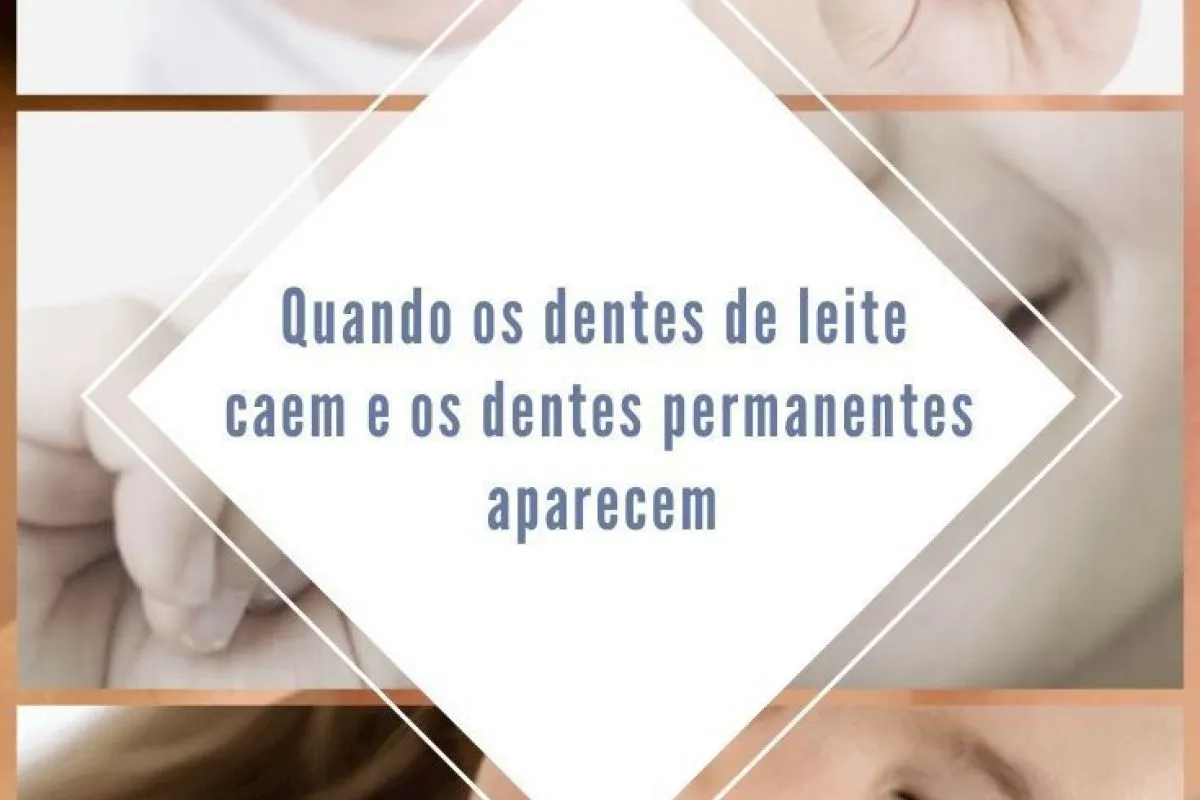 que dentes caem?