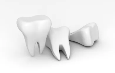Dentes Perfeitos