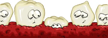 dente anquilosado