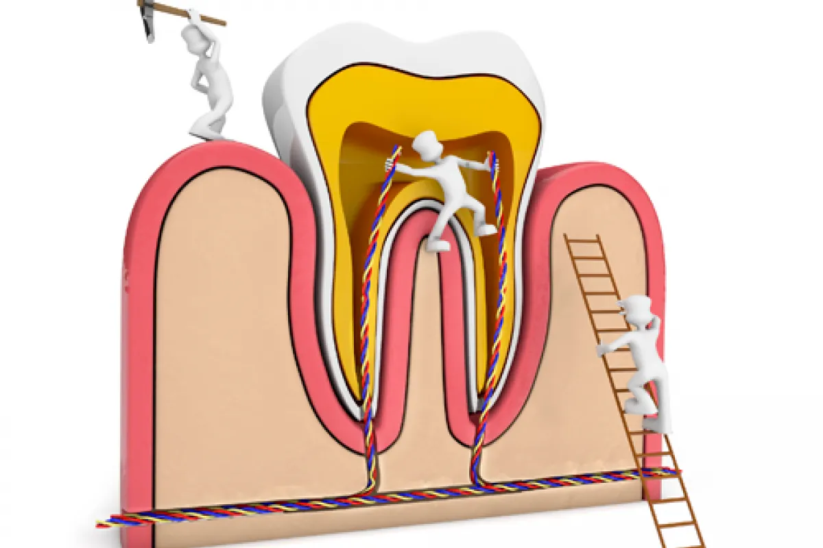 Dente com cárie mas não dói