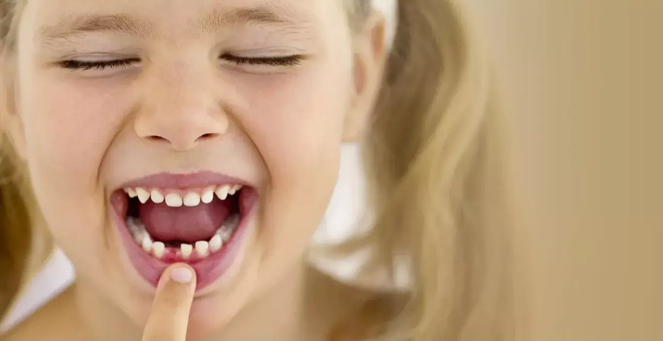 Extração de dente de leite em criança